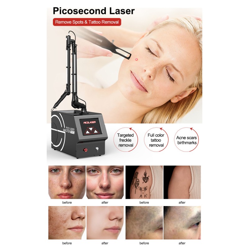 Laser Helmet Factory - High Quality Portable LLLT 650nm LED