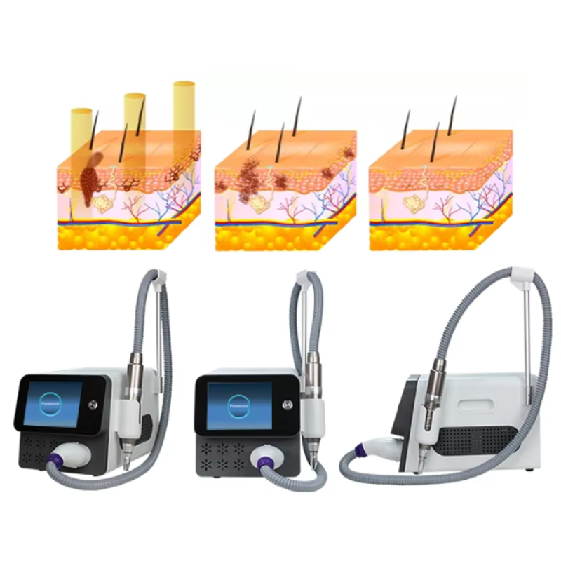 Skin Cooling Machine Factory - 2025 Portable -20° Cryo Chiller