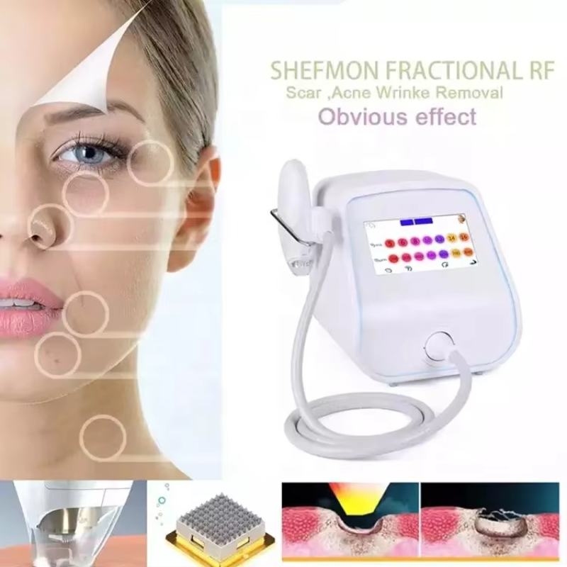 RF Microneedling Machine Supplier - Acne Treatment Fractional RF