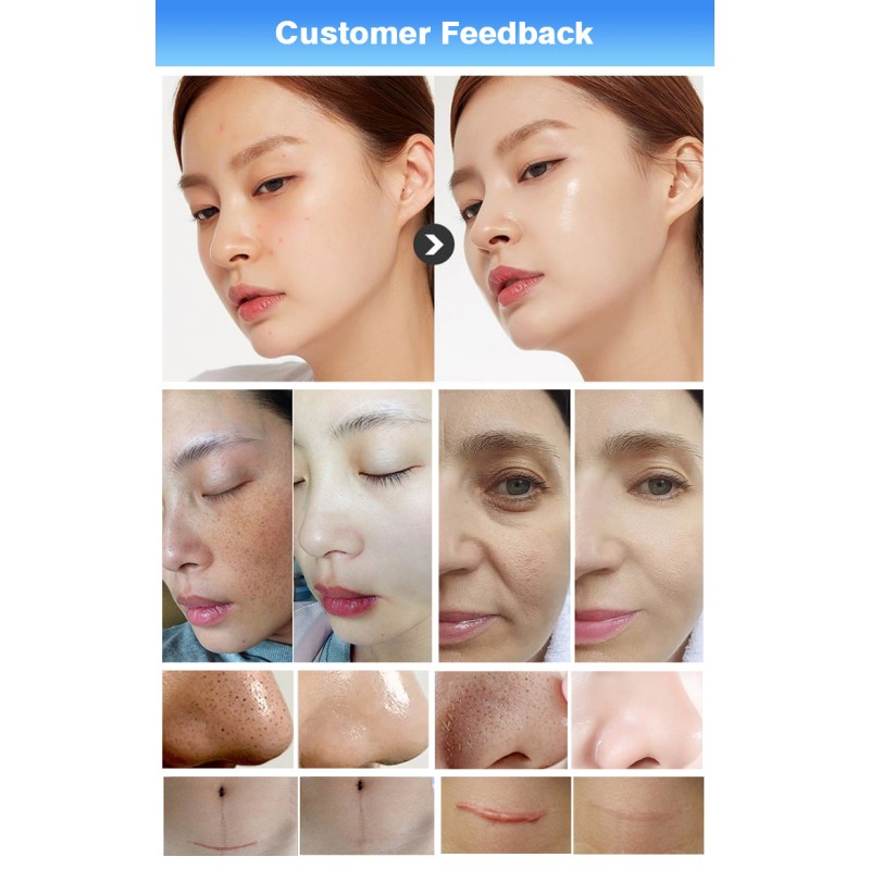 Hydrodermabrasion Machine Manufacturer - Professional 14 in 1 Cleaning