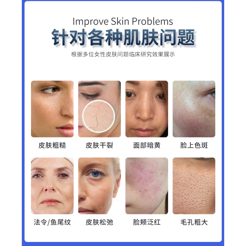 RF Microneedling Machine Manufacturer - Micro Needle Face Lifting