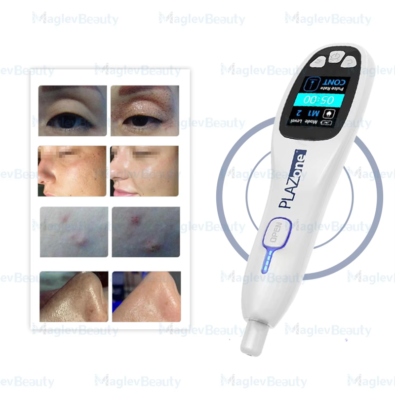 Plasma Pen Manufacturer - Professional Jet Cold Ozone