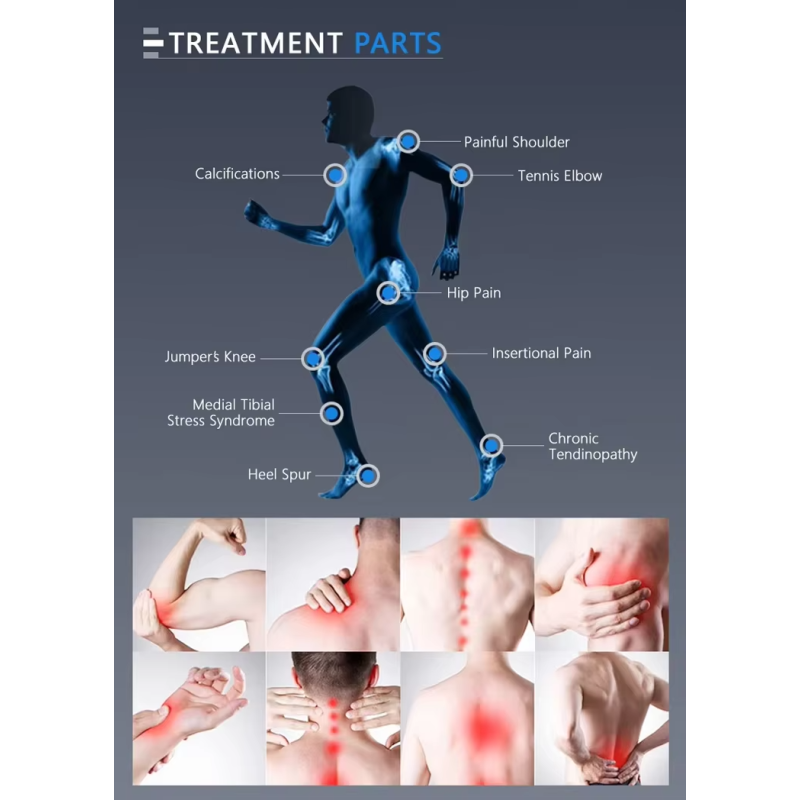 Shock Wave Therapy Manufacturer - Clinic Extracorporeal Erectile Dysfunction