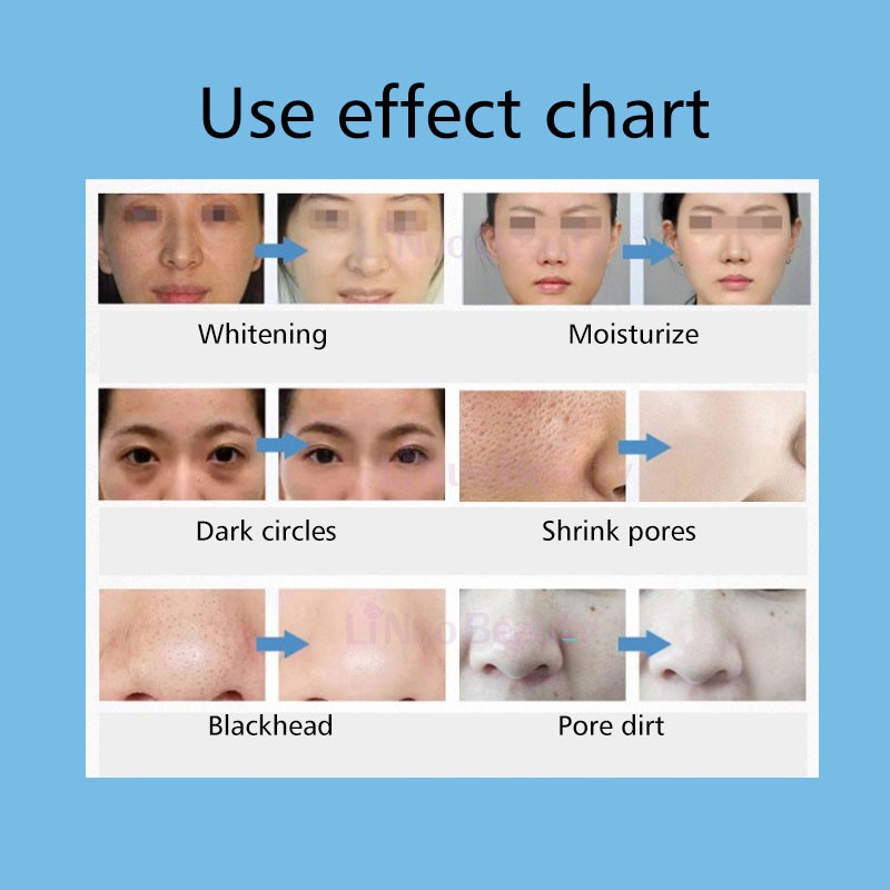 Hydrodermabrasion Machine Manufacturer - New Product Aqua Peel Up