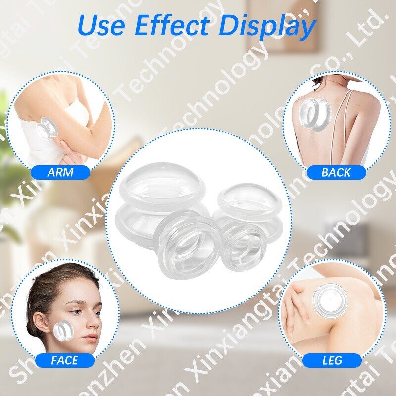 Cupping Cup Manufacturer - XL L M S Size Transparent Hijama Suction