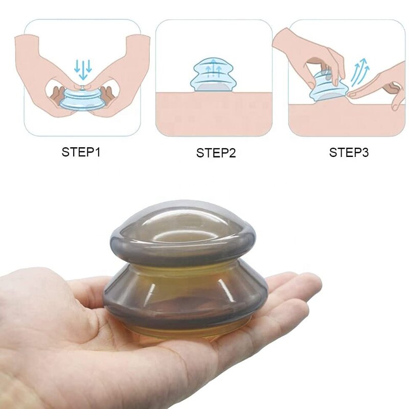 Cupping Cup Supplier - XL L M S Size Transparent Hijama Set