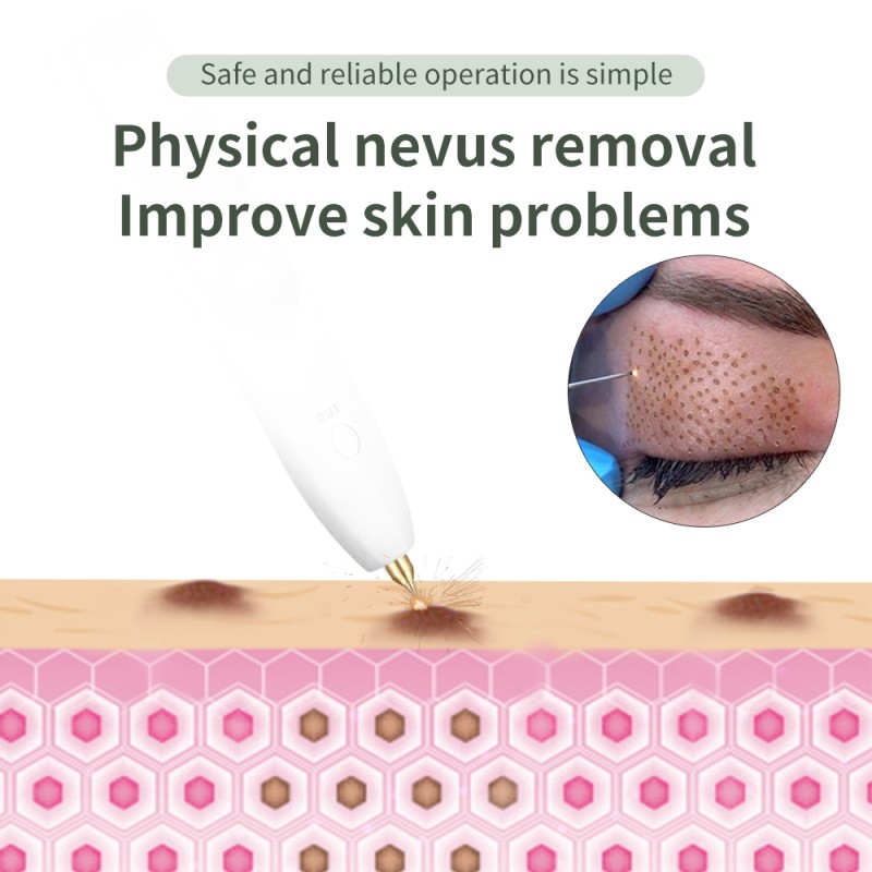 Medical Plasma Pen Factory - Hot Sale Eyelids Lifting Ozone