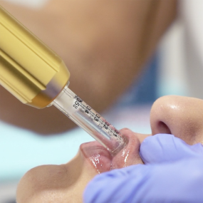 Automatic Injector Factory - Facial Lip Filler Hyalurone Pen