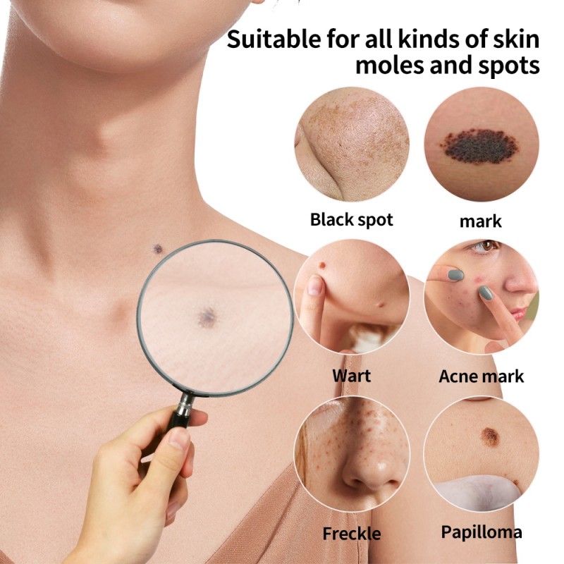 Plasma Pen Manufacturer - 2-in-1 Ozone Acne Mole Sweep Pen