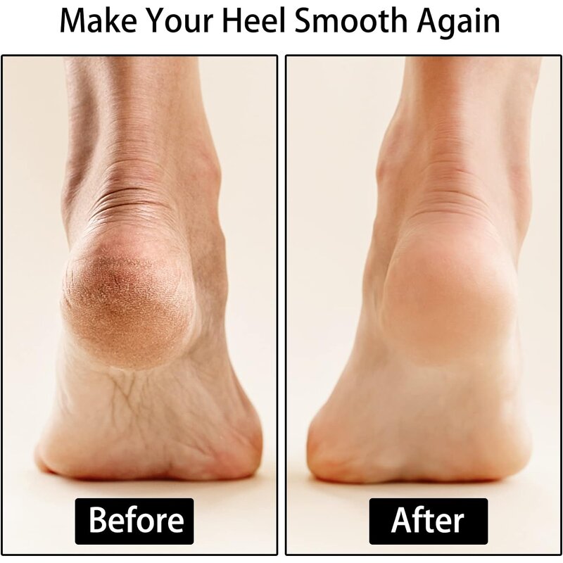 Ankle Socks - 100% Cotton Unisex for Dry Cracked Skin & Sports Support