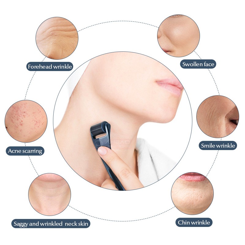 Microneedling Roller Manufacturer - 1200 Pins Stainless Steel Beard