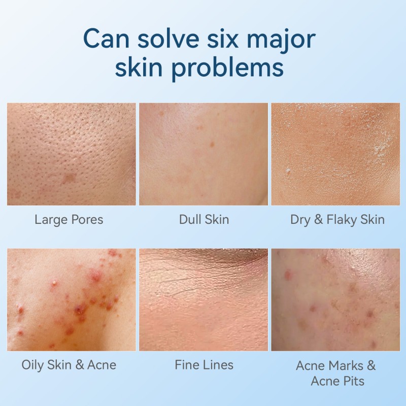 Anti Wrinkles Derma Pen Factory - Hello Face S03 LED Face Lifting