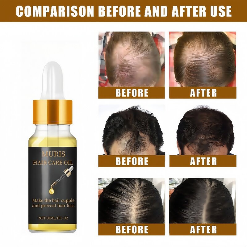 Hair Oil - Plant-based Anti-itching Repairing Precisely Moisturize