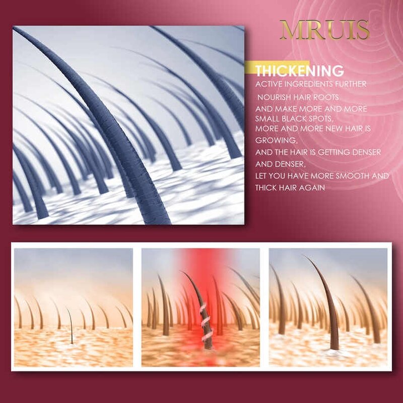 Red Onion Oil - MRUIS Natural Organic Scalp Nourishing Hair Growth