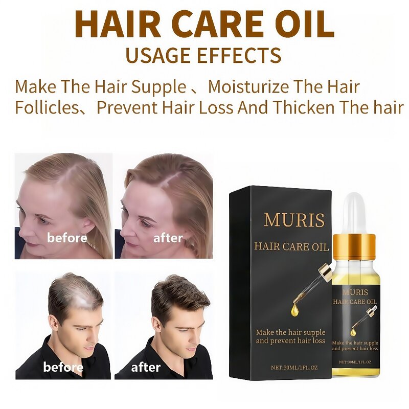 Hair Oil - Plant-based Anti-itching Repairing Precisely Moisturize