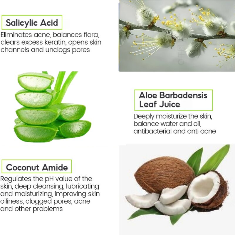 Salicylic Acid Soap Bar - 100g Deep Cleansing Anti-Acne Whitening