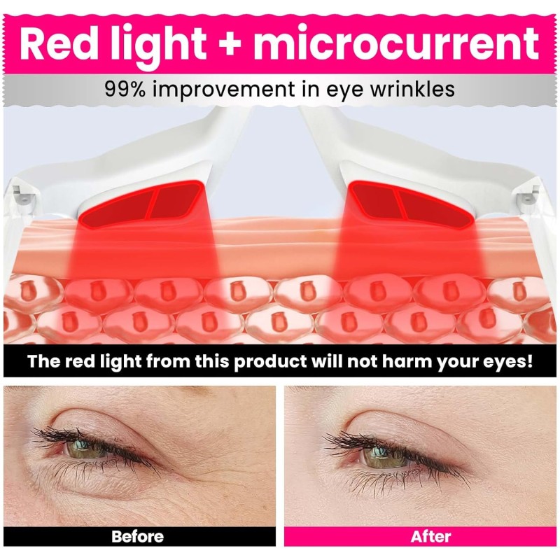 Eye Massager Manufacturer - Customized 3D EMS Redlight Anti-fatigue