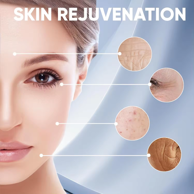 Derma Roller Supplier - Customize Logo Hair Growth 540 Needles