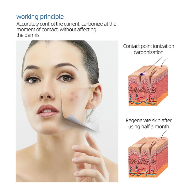 Fibroblast Plasma Pen Supplier - Professional Picosecond Eyelid