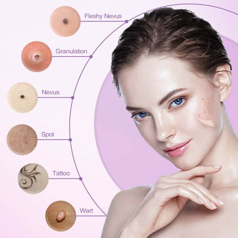 Laser Plasma Pen Supplier - 9 Adjustable Levels LCD Display