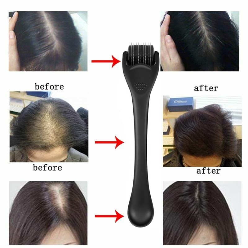 Derma Roller Manufacturer - 540 Titanium Matte Black