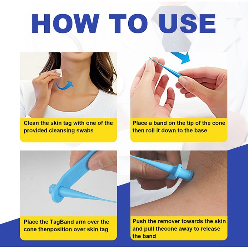 Skin Tag Removal Pen Manufacturer - Micro Auto Fast
