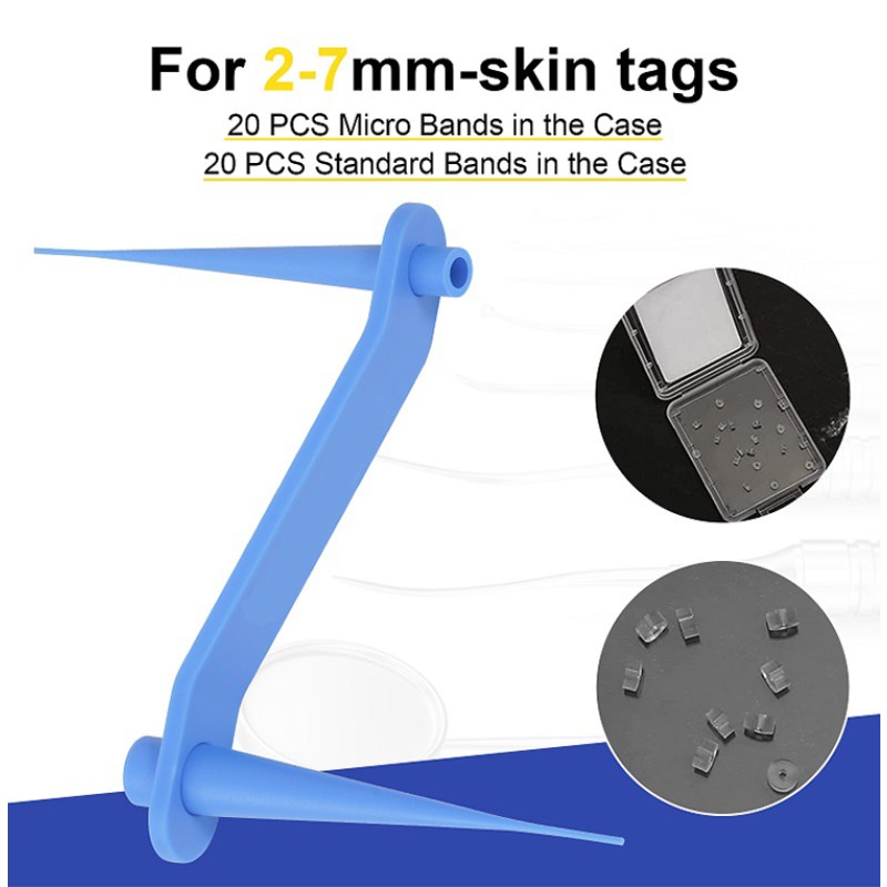 Skin Tag Remover Supplier - OEM Private Label Kit