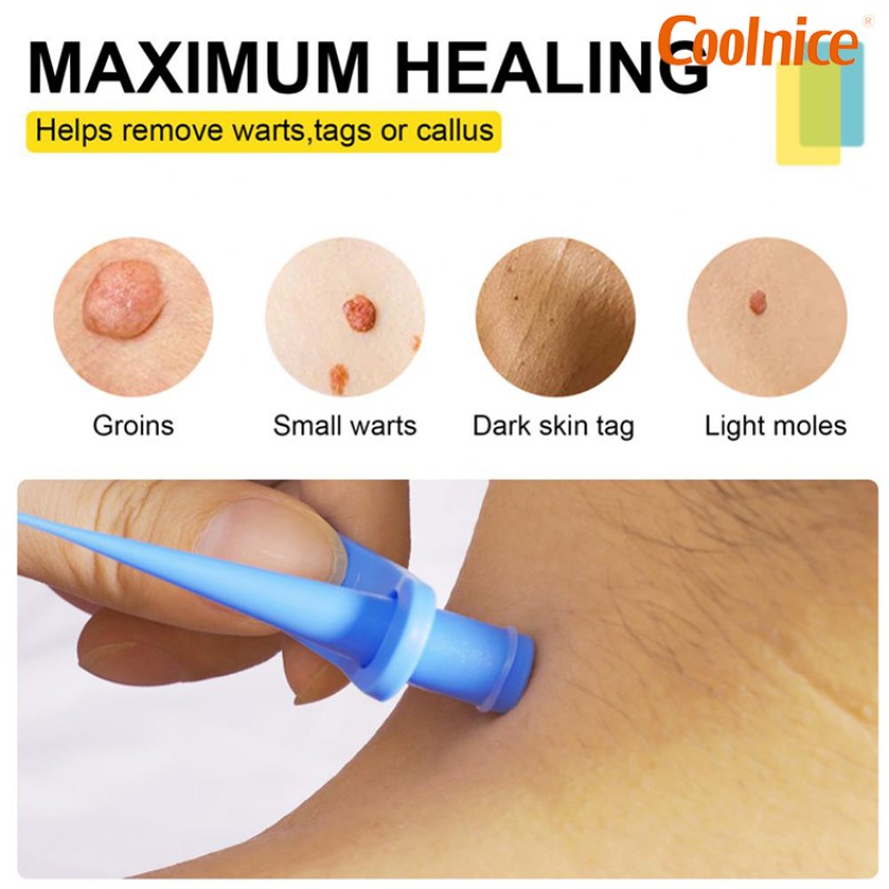 Skin Tag Remover Supplier - OEM Private Label Kit