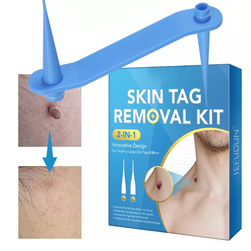 Skin Tag Removal Pen Manufacturer - Micro Auto Fast