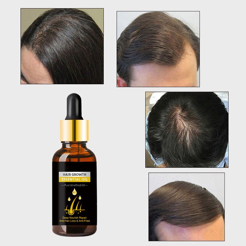 Hair Regrowth Serum Manufacturer - Bestselling Deeply Nourishes Repairs Prevents Hair Loss Improves Texture