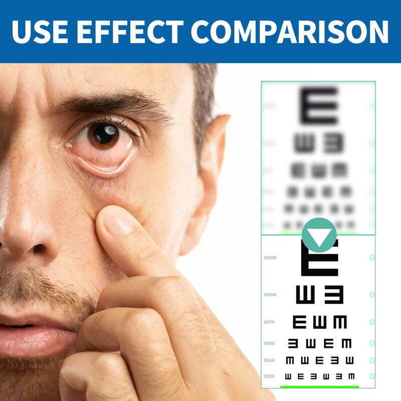 Eye Strain Cream Manufacturer - Relieve Dryness Improve Blurred Vision Dry Eyes Treatment Moisturizer Cold Compress Gel