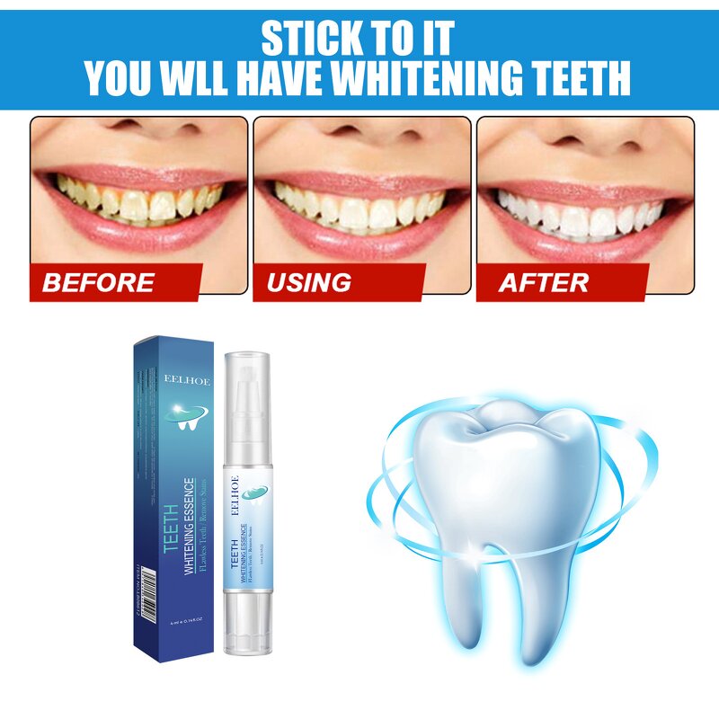 Teeth Whitening Pen Manufacturer - Private Label Bright Whitening Peroxide Dental Yellow Plaque Stain Remover