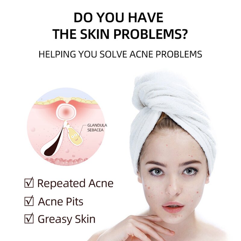 Anti-Acne Face Gel Manufacturer - Private Label Quick Salicylic Acid Herbal for Pimples and Scars