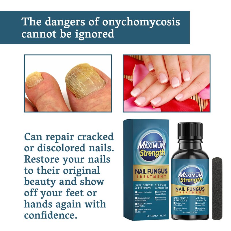 Nail Repair Serum Gel Manufacturer - Maximum Strength Anti-Infection for Onychomycosis Paronychia Fungal Treatment