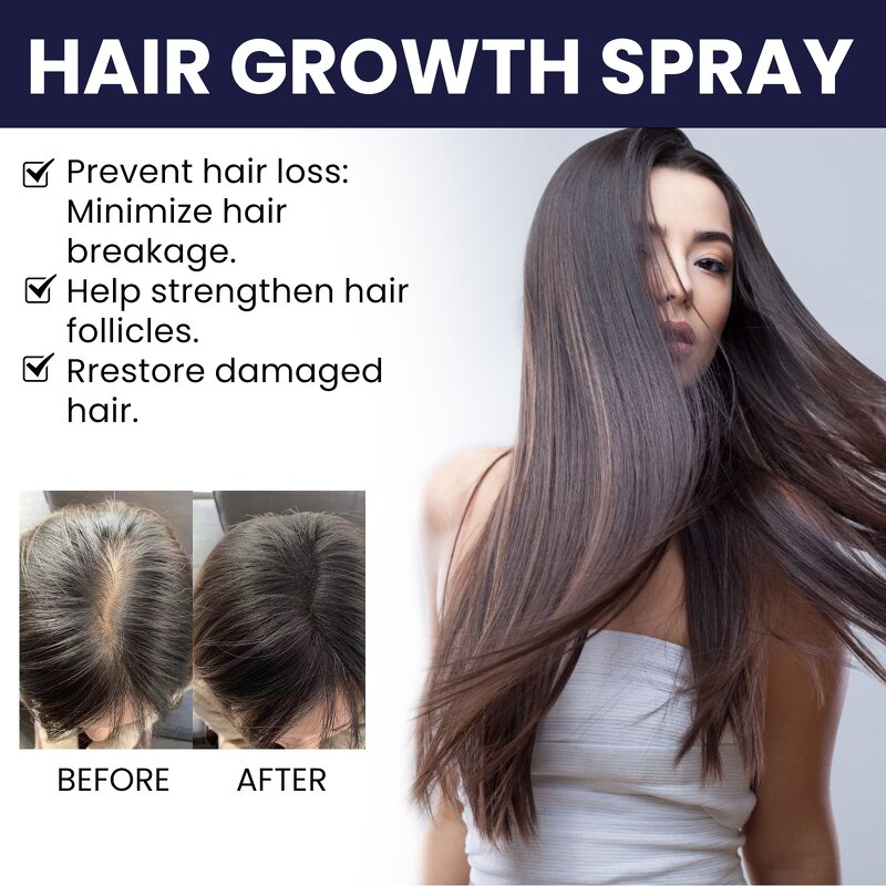 Hair Growth Spray Manufacturer - Private Label 100% Organic Herbal Treatment Repairing Regrowth Oil Serum