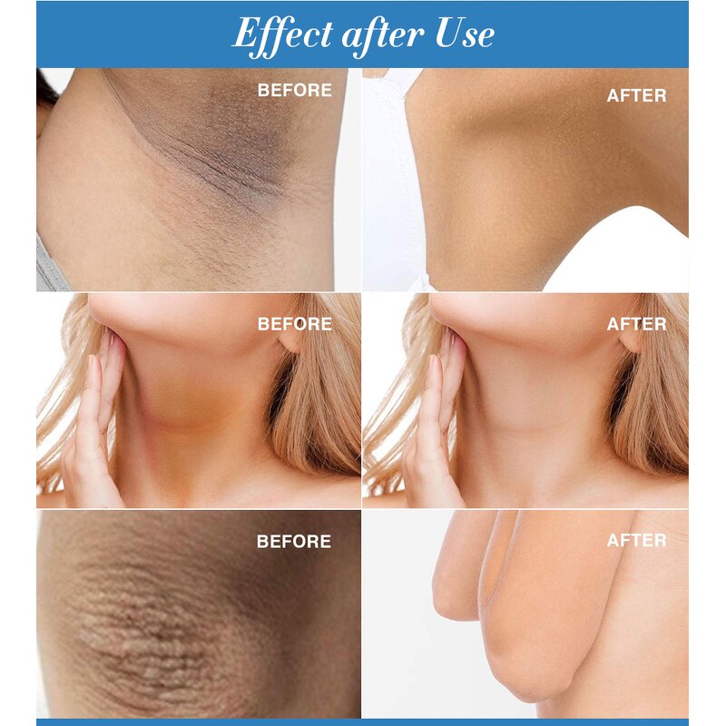 Whitening Cream Manufacturer - Dark Spot & Fine Pores Lightening for Knees Hands Armpits