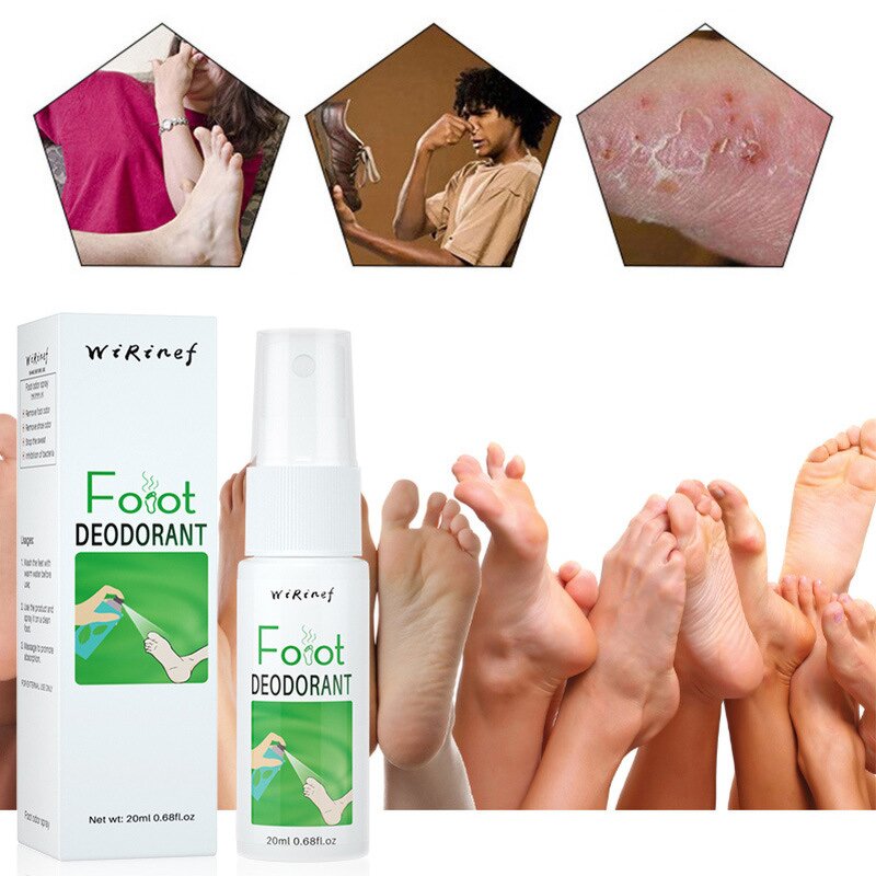 Foot Odor Removal Spray Manufacturer - 2022 New Product Hot Sale Beriberi Treatment Care Shoe Deodorant
