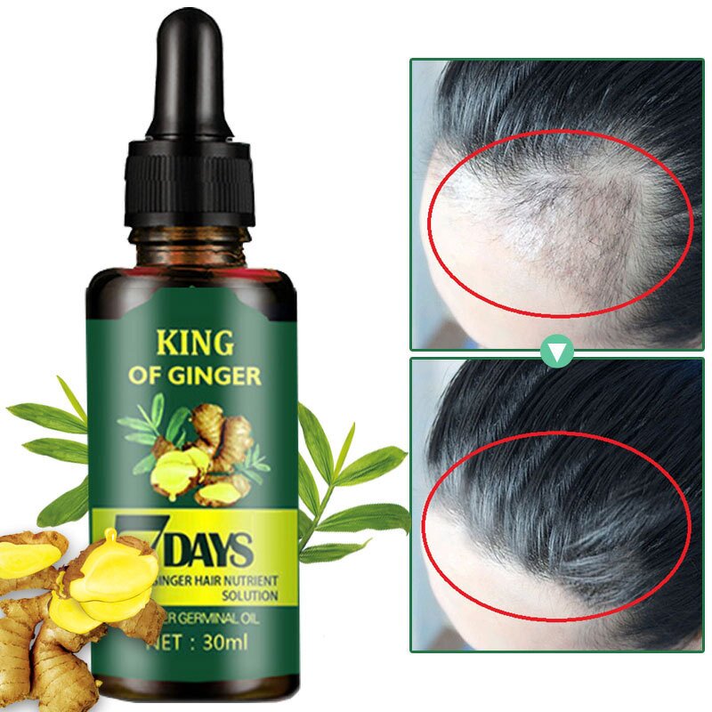 Ginger Essential Oil Manufacturer - 7 Days Pure Improving Hair Growth Anti Hair Loss Treatment for Men