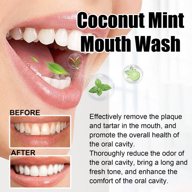 Mouth Wash Manufacturer - Hot Selling Natural Plant Essential Oils Fresh Breath Teeth Whitening Mint Coconut Oil