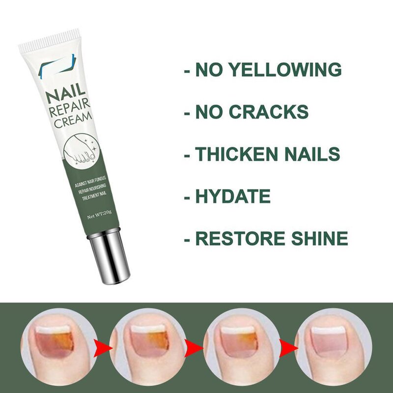 Nail Repair Cream Manufacturer - OEM/ODM Private Label Herbal Lightweight Skin-Friendly Best Fungal Treatment for Foot Care