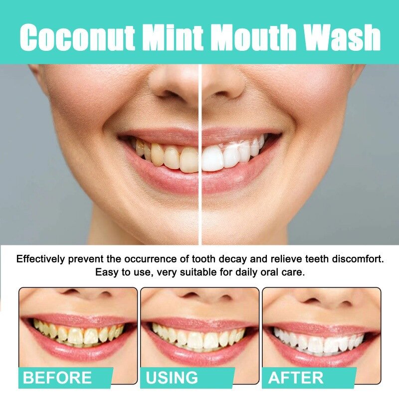 Mouth Wash Manufacturer - Hot Selling Natural Plant Essential Oils Fresh Breath Teeth Whitening Mint Coconut Oil