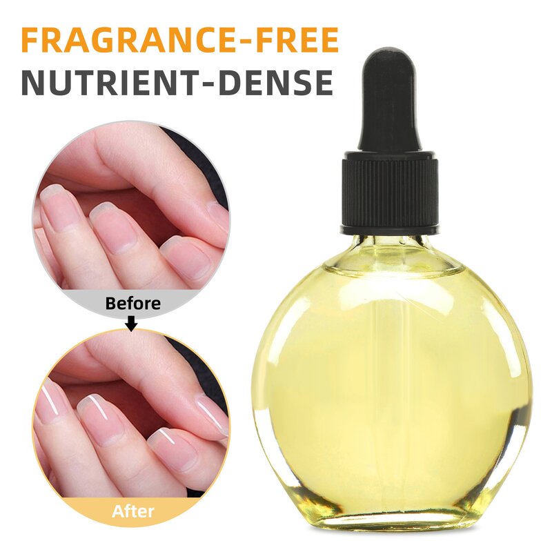 Nail Cuticle Oil Manufacturer - Oem Custom Private Label Organic Soften Dead Skin Barb Moisturize Skin Bulk