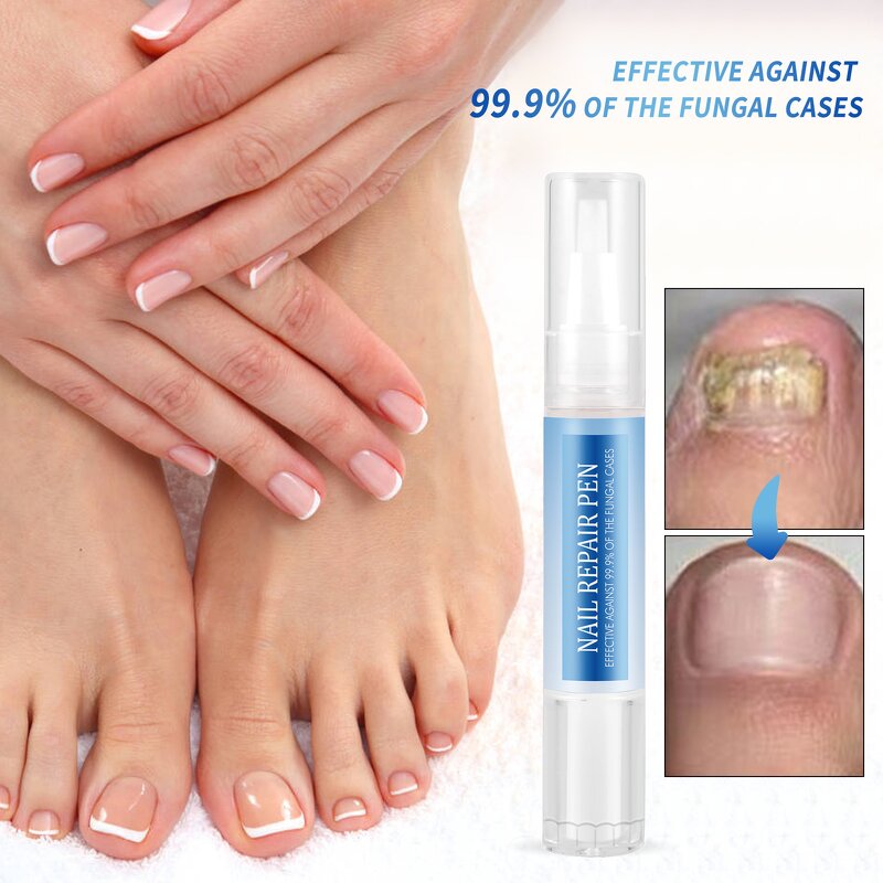 Nail Care Oil Essence Kit Manufacturer - New Products Beauty Personal Care Provides Nutrition Fungal Nail Repair Pen