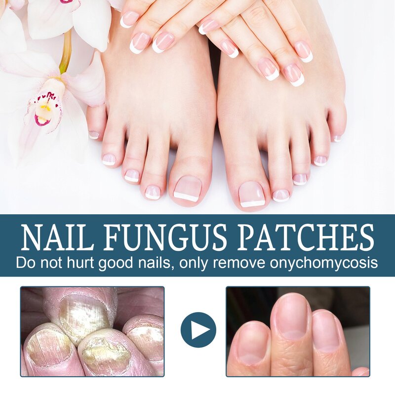 Nail Repair Serum Gel Manufacturer - Maximum Strength Anti-Infection for Onychomycosis Paronychia Fungal Treatment