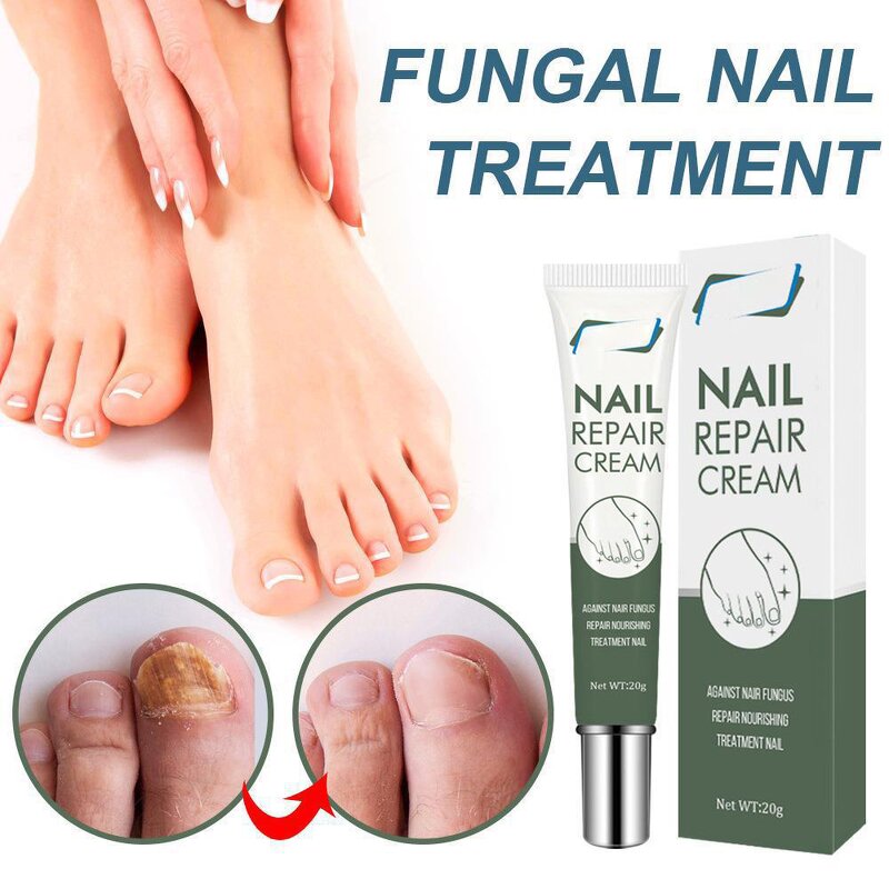 Nail Repair Cream Manufacturer - OEM/ODM Private Label Herbal Lightweight Skin-Friendly Best Fungal Treatment for Foot Care