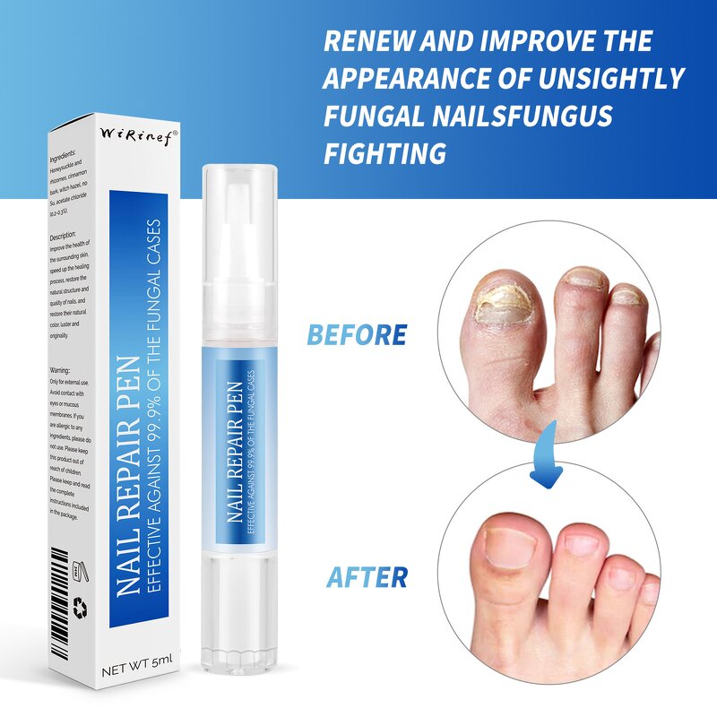 Nail Care Oil Essence Kit Manufacturer - New Products Beauty Personal Care Provides Nutrition Fungal Nail Repair Pen