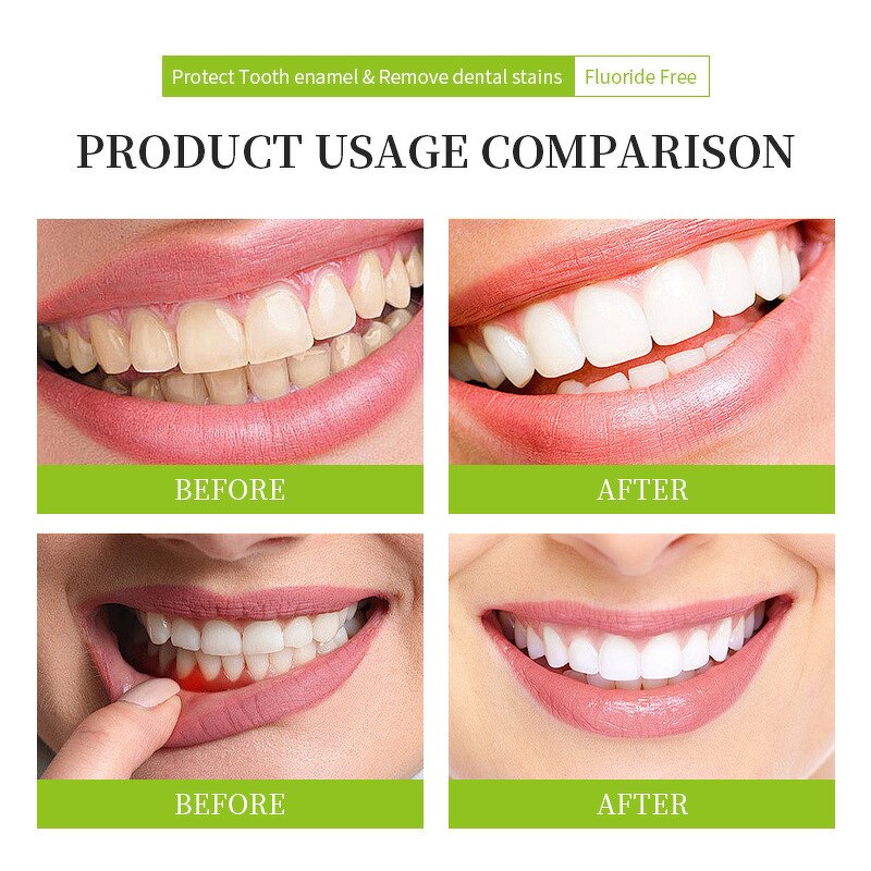 Toothpaste Manufacturer - Private Label Nature Mint Anti Sensitivity Whitening Bamboo Charcoal - OEM