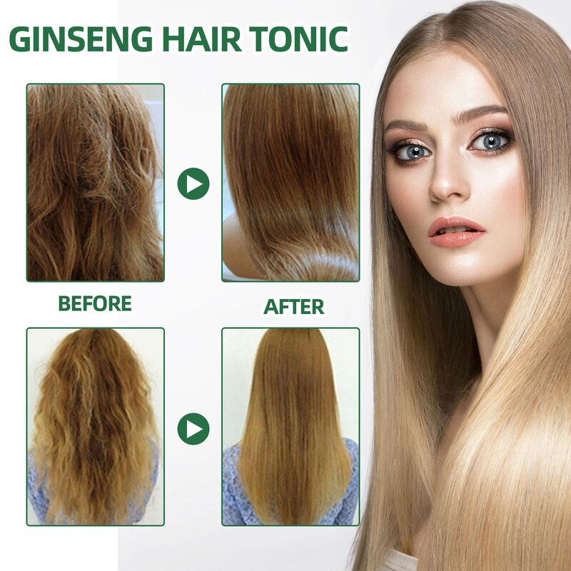 Hair Growth Spray Manufacturer - Hot Sell Fast Growing Keratin Essential Oil Natural Herbal Prevent Hair Loss