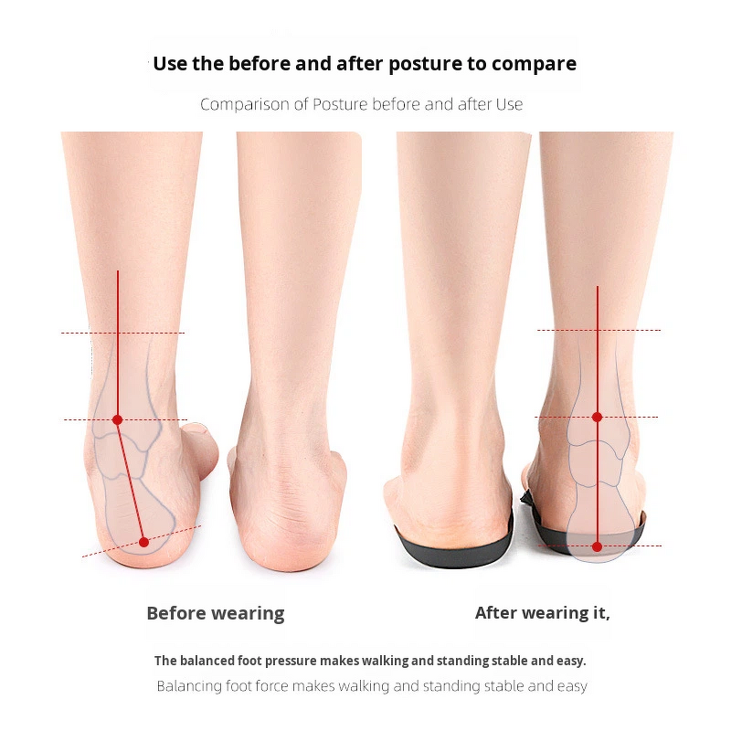 Arch Support Inserts Manufacturer - for Women Men 3/4 Length Shoe Orthotics Insoles Shoe Insoles