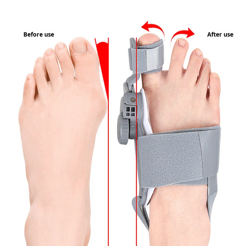 Bunion Corrector Manufacturer - for Women Men Upgraded Big Toe Straightener Orthopedic Bunions Splint for Hallux Valgus
